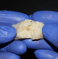 Physician pulling apart a molded OsteGro sample